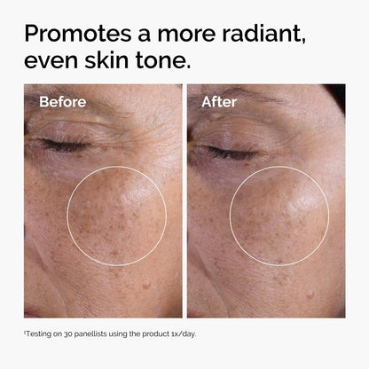 Glycolic Acid 7% Exfoliating and Brightening Daily Toner results promoting radiant skin tone.