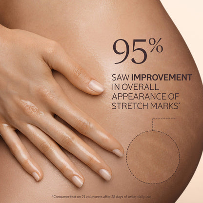 Smoothing and Firming Almond Supple Skin Body Oil improves stretch mark appearance.
